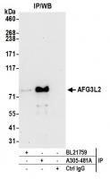 Detection of human AFG3L2 by western blo