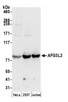 Detection of human AFG3L2 by western blo