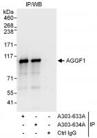 Detection of human AGGF1 by western blot