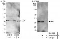 Detection of human AIP by western blot a