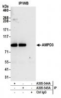 Detection of human AMPD3 by western blot
