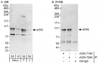 Detection of human ATF6 by western blot 