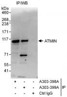 Detection of human ATMIN by western blot