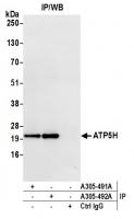 Detection of human ATP5H by western blot