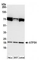 Detection of human ATP5H by western blot