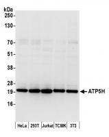 Detection of human and mouse ATP5H by we