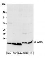 Detection of human and mouse ATP5I by we