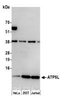 Detection of human ATP5L by western blot