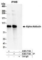 Detection of human Alpha-Adducin by west