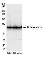 Detection of human Alpha-Adducin by west
