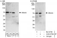 Detection of human Atherin by western bl
