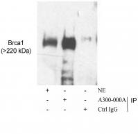 Detection of human BRCA1 by western blot