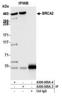Detection of human BRCA2 by western blot