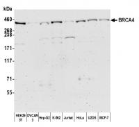 Detection of human BRCA4 by western blot