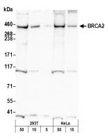 Detection of human and mouse BRCA2 by we