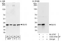 Detection of human Bcl10 by western blot