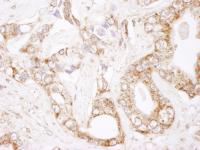 Detection of human Bcl-2 by immunohistoc