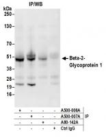 Detection of human Beta-2-Glycoprotein 1