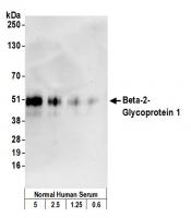 Detection of human Beta-2-Glycoprotein 1