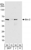 Detection of human Brn-2 by western blot