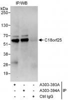 Detection of human C18orf25 by western b