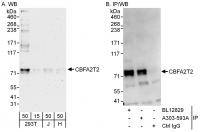 Detection of human CBFA2T2 by western bl