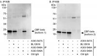 Detection of human CBF-beta by western b