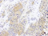 Detection of mouse CCT2 by immunohistoch