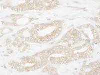 Detection of human CCT2 by immunohistoch