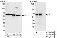 Detection of human and mouse CCT2 by wes