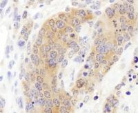 Detection of mouse CCT3 by immunohistoch