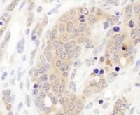 Detection of mouse CCT3 by immunohistoch