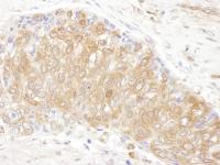 Detection of human CCT3 by immunohistoch