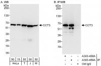 Detection of human and mouse CCT3 by wes