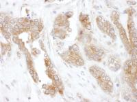 Detection of human CCT5 by immunohistoch