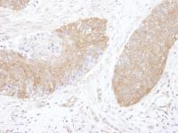 Detection of human CCT5 by immunohistoch