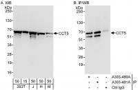 Detection of human and mouse CCT5 by wes