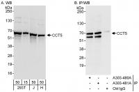 Detection of human CCT5 by western blot 