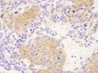 Detection of mouse CCT8 by immunohistoch