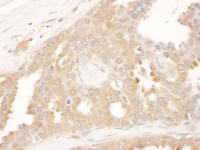 Detection of human CCT8 by immunohistoch
