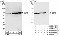 Detection of human and mouse CCT8 by wes
