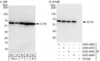 Detection of human and mouse CCT8 by wes