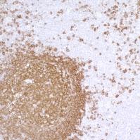 Detection of human CD20 by immunohistoch
