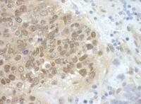 Detection of mouse CDC6 by immunohistoch