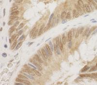 Detection of human CDC6 by immunohistoch