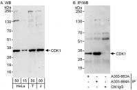 Detection of human CDK1 by western blot 