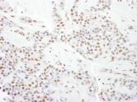 Detection of human CDK9 by immunohistoch