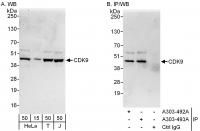 Detection of human CDK9 by western blot 