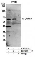 Detection of human COASY by western blot