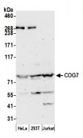 Detection of human COG7 by western blot.